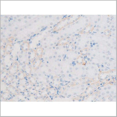 product-image-AAA31055_IHC17.jpg