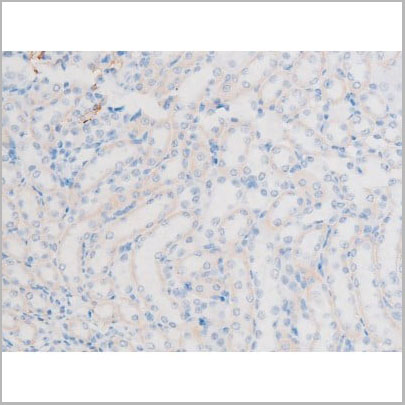 product-image-AAA31055_IHC18.jpg