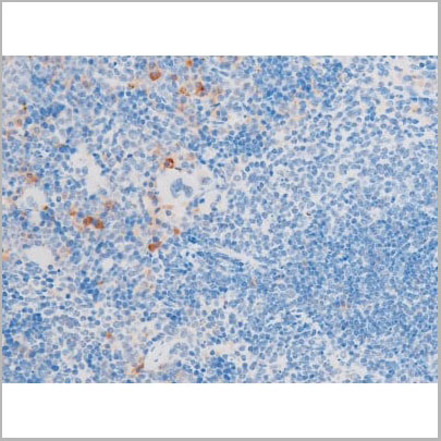 product-image-AAA31055_IHC20.jpg