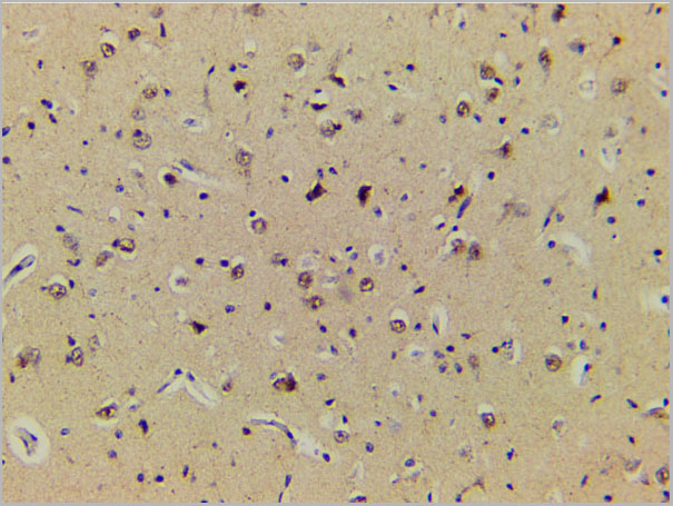 product-image-AAA31055_IHC3.jpg