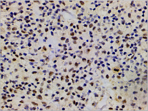 product-image-AAA31055_IHC5.jpg