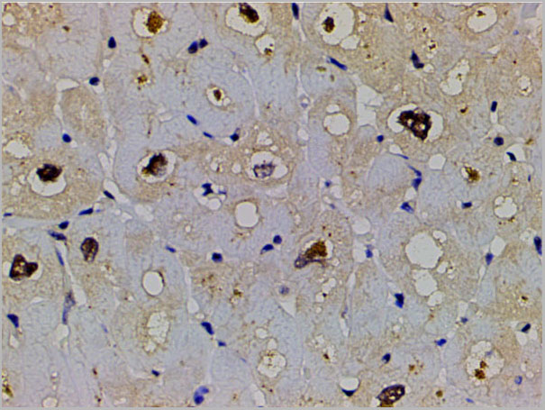 product-image-AAA31055_IHC6.jpg