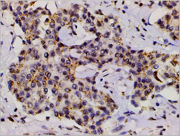 product-image-AAA31055_IHC7.jpg