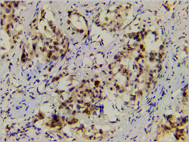 product-image-AAA31055_IHC8.jpg