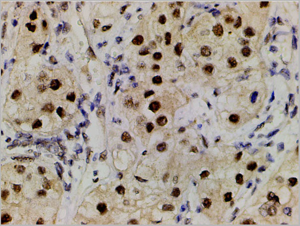 product-image-AAA31055_IHC9.jpg