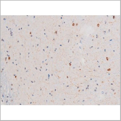 product-image-AAA31056_IHC10.jpg