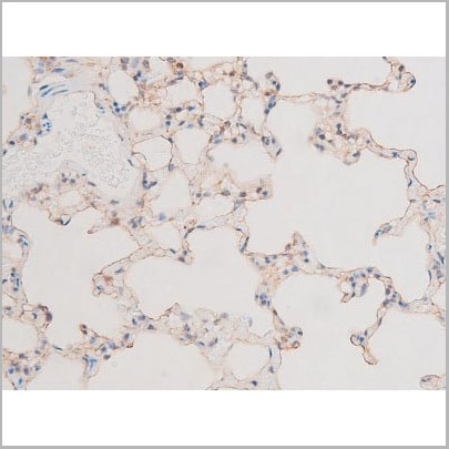 product-image-AAA31056_IHC11.jpg