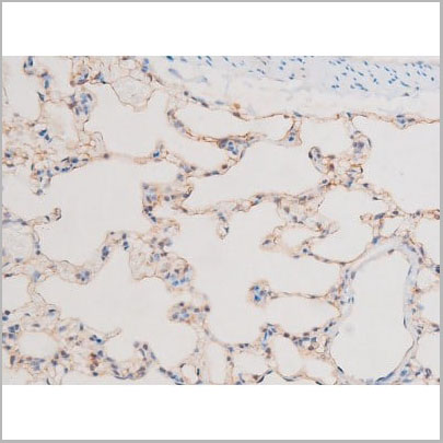 product-image-AAA31056_IHC12.jpg