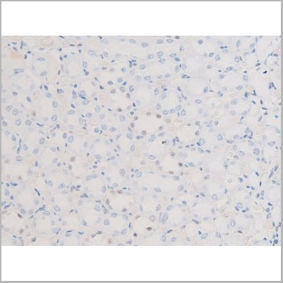 product-image-AAA31056_IHC14.jpg
