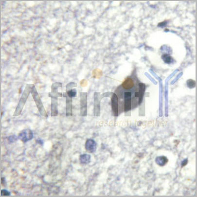 product-image-AAA31056_IHC15.jpg