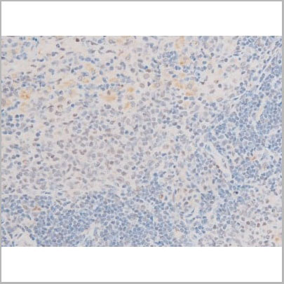 product-image-AAA31056_IHC17.jpg