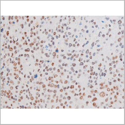 product-image-AAA31056_IHC2.jpg