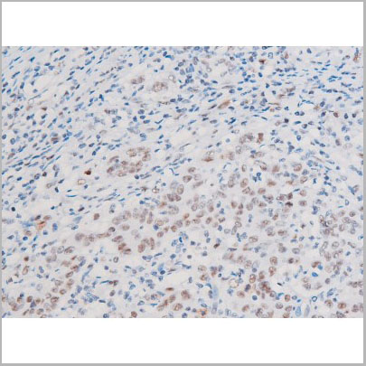 product-image-AAA31056_IHC3.jpg