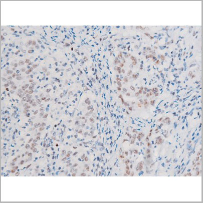 product-image-AAA31056_IHC4.jpg