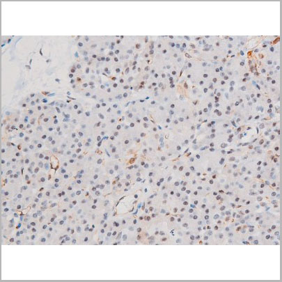 product-image-AAA31056_IHC5.jpg