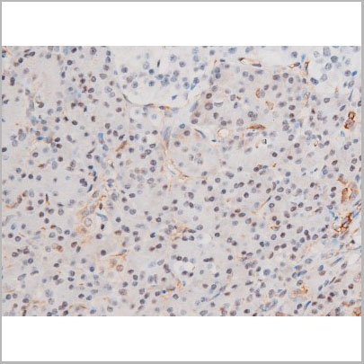 product-image-AAA31056_IHC6.jpg