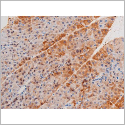 product-image-AAA31056_IHC7.jpg