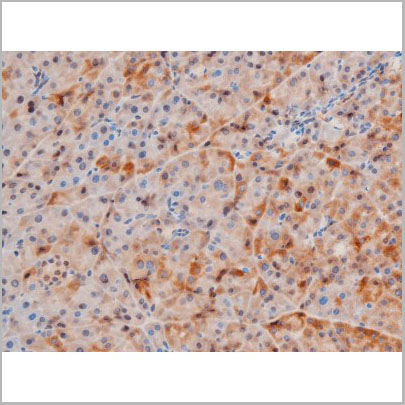 product-image-AAA31056_IHC8.jpg