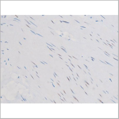 product-image-AAA31058_IHC3.jpg