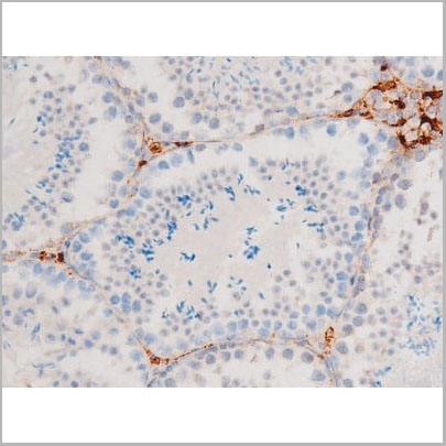 product-image-AAA31058_IHC4.jpg