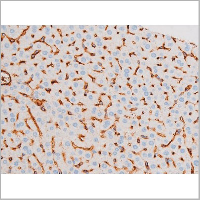 product-image-AAA31058_IHC5.jpg