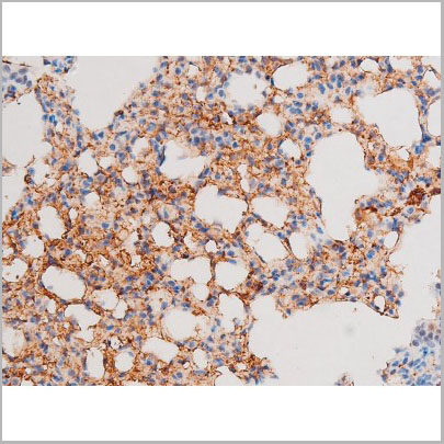 product-image-AAA31058_IHC6.jpg