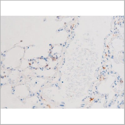product-image-AAA31059_IHC2.jpg