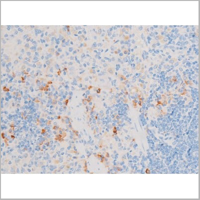 product-image-AAA31059_IHC3.jpg