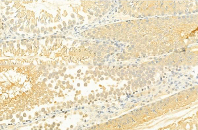 product-image-AAA31059_IHC5.jpg