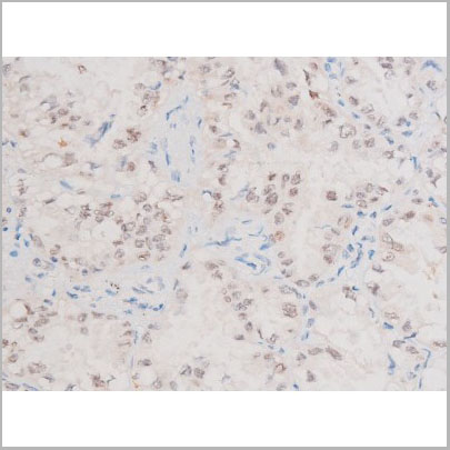 product-image-AAA31060_IHC2.jpg