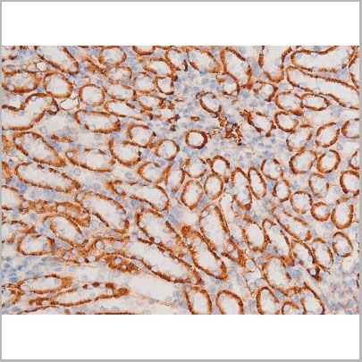 product-image-AAA31060_IHC3.jpg