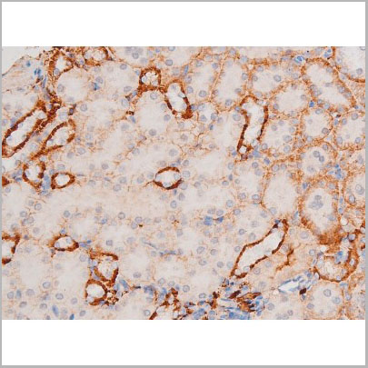 product-image-AAA31060_IHC4.jpg