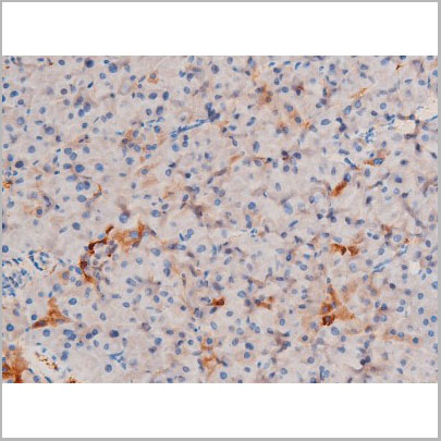 product-image-AAA31060_IHC5.jpg