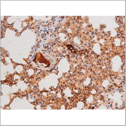 product-image-AAA31061_IHC11.jpg