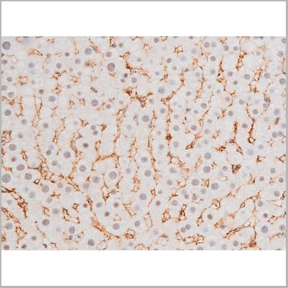 product-image-AAA31061_IHC13.jpg