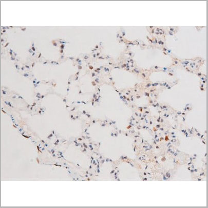 product-image-AAA31061_IHC14.jpg