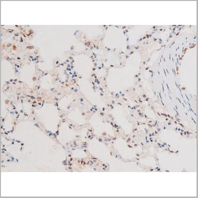 product-image-AAA31061_IHC15.jpg