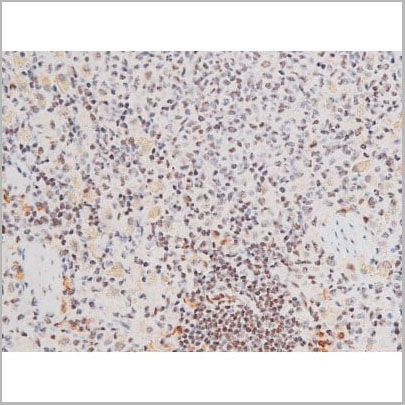 product-image-AAA31061_IHC16.jpg
