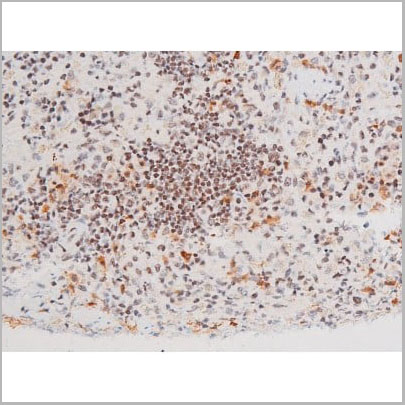 product-image-AAA31061_IHC17.jpg
