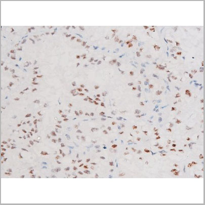 product-image-AAA31061_IHC2.jpg
