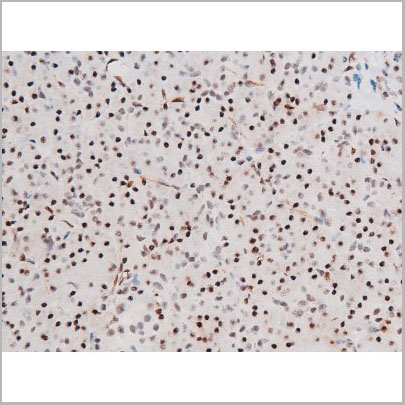 product-image-AAA31061_IHC4.jpg