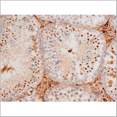 product-image-AAA31061_IHC6.jpg