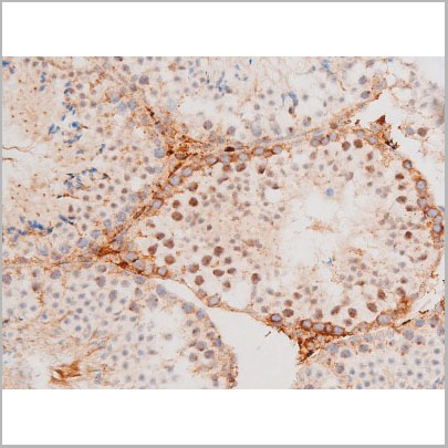 product-image-AAA31061_IHC7.jpg