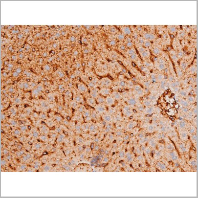 product-image-AAA31061_IHC8.jpg