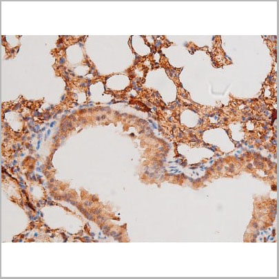product-image-AAA31062_IHC12.jpg