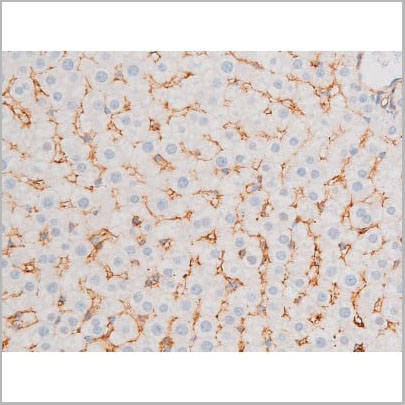 product-image-AAA31062_IHC14.jpg