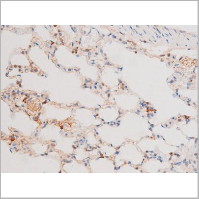 product-image-AAA31062_IHC15.jpg