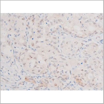 product-image-AAA31062_IHC2.jpg
