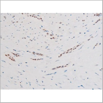 product-image-AAA31062_IHC6.jpg