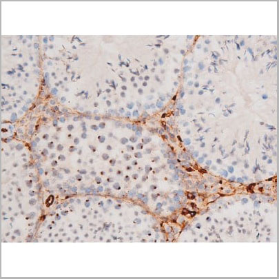 product-image-AAA31062_IHC7.jpg
